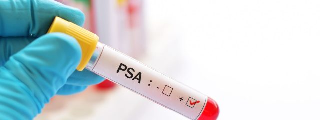 Saiba como o exame PSA atua na prevenção do câncer de próstata