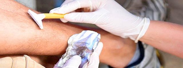 Você sabe para que serve o exame toxicológico?